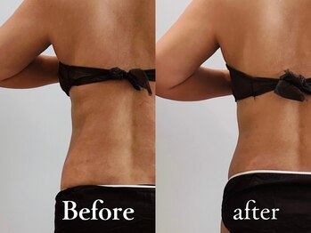 スリラ(SuriLa)/◆ビフォーアフター◆