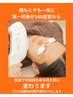 【平日限定♪/都度払い】顔全体脱毛＋胸全体＋腹全体脱毛　14300円→11000円