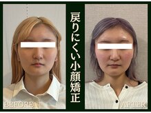 リエイド 札幌院(Re Aid.)の雰囲気（根本アプローチで重ねるたびに戻りづらい小顔矯正。）