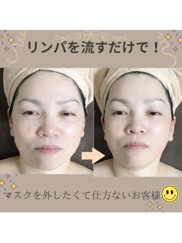 メディカルサロン かとれあ/シェイプリフト