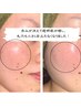【肌ケア★ヘッドスパ×ヒト幹細胞】シミくすみケア◆ヒト幹細胞導入¥28000→