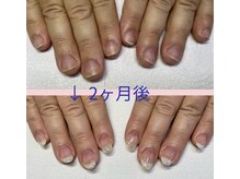 ブルームブルーム(BLOOMブルーム)/お客様ネイル