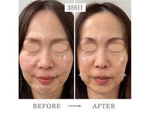ビューイング(美ing)の雰囲気（毛穴.たるみ.くすみ.フェイシャルケア/痩身ヘッドスパ/脱毛/小顔）