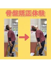 ひよこ整骨院/骨盤矯正Before→Ａfter