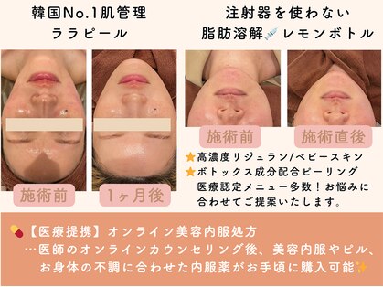 ミーカラー(mecalla.)の写真