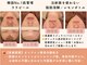 ミーカラー(mecalla.)の写真