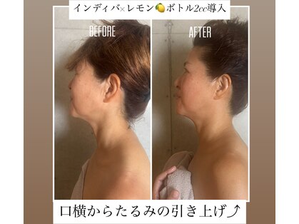 インディバサロン カルム(Calm.)の写真