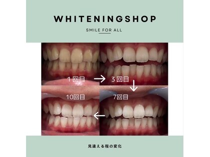 ホワイトニングショップ 山科店の写真