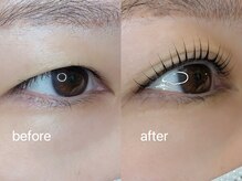 アイラブ(eye love)/