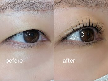 アイラブ(eye love)/