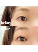 ブリリーアイ サロン(brilieye salon)/目の形が変わります！