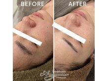 アンジェーム(ANGEAME)/スキンケアだけでも変わります！