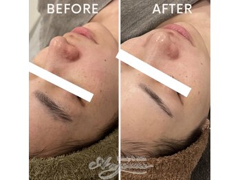 アンジェーム(ANGEAME)/スキンケアだけでも変わります!