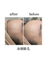 エステティックレイビス 弘前店(RAYVIS)/