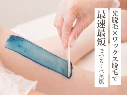 シャンティ(Shanti)の写真