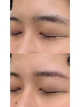 エムシー葵(MC葵)/アイブロウwax脱毛