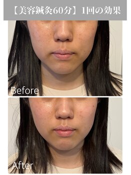 サンクエール 代官山鍼灸院(CINQ AILES)/美容鍼灸