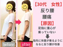 西宮かなで整体院/反り腰と腰痛が同時に改善