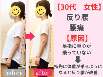 西宮かなで整体院/反り腰と腰痛が同時に改善