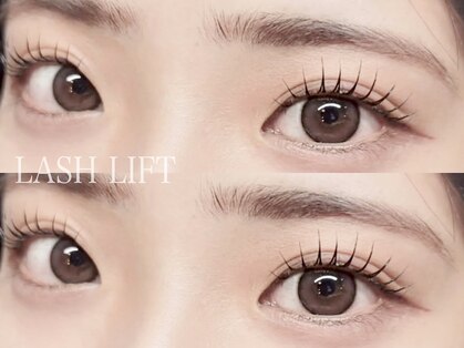 フィー(Fee)の写真