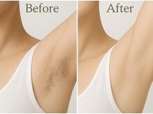 シェリラ(cherela)の雰囲気（リラクゼーションのついでに【ちょこっと脱毛】大人気♪）