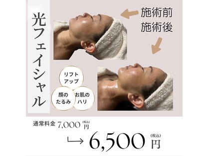 リラクゼーションエステ マーミー(maamii)の写真