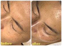 ベルドア(Bell Door)/目もと/小じわケア