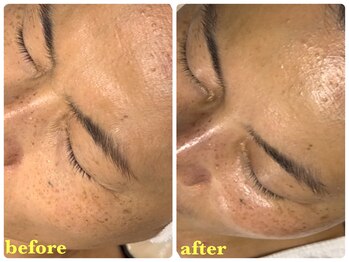 ベルドア(Bell Door)/目もと/小じわケア