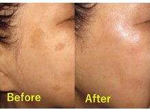 サロン ド トゥシャン(Salon de touchant)の雰囲気（シミ改善プログラムでお肌の総入れ替えでターンオーバーを正常化）