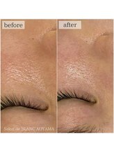 サロン ド ブラン アオヤマ(Salon de BLANC AOYAMA)/クリスティーナ美白ケア