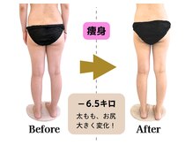 ケント整体院 ルース(KENT整体院 | Luz)の雰囲気（効果実感◎下半身すっきり！豊富なダイエットメニュー有♪）