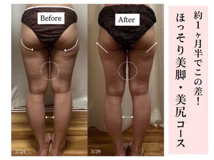 ミルティー(Myrtille)の写真