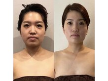 ビースリー(b3)の雰囲気（★人気★小顔コルギ×デコルテ×背中！初回の効果は1週間♪）