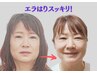感動の【エラ張りをすつきり美小顔へ】お試し￥14800→￥9800
