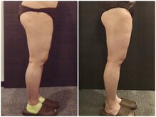 美容整体 ウェリナ 蟹江院/小顔矯正/骨盤矯正/美脚サロン 