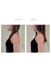 ユーニマルヨン(ewe204)/ブライダル8回コース×2回