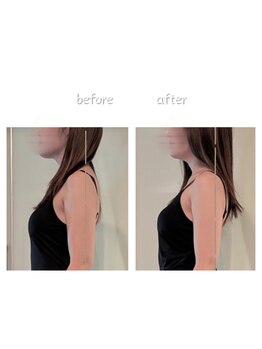 ユーニマルヨン(ewe204)/ブライダル8回コース×2回