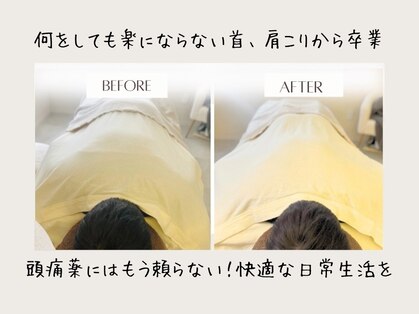 マイスパ(MY SPA)の写真