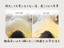 マイスパ(MY SPA)