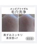 【メンズブライダル】黒ずみ・皮脂スッキリ毛穴洗浄 ¥15,400→¥8,800