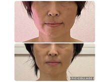 ルピナージュ(Lupinage)の雰囲気(【たるみ改善】集中3ヶ月!)