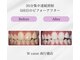 ダブルカラット 南行徳店(W carat)の写真/【南行徳徒歩2分】リーズナブルな価格で圧倒的な白さを手に入れませんか？貴方の笑顔をさらに魅力的に☆