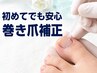 【初めてでも安心】軽度の巻き爪補正　★1本￥4,400 ★両足親指2本￥6,600