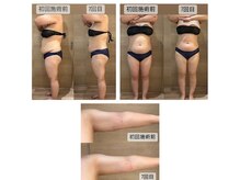 リア(Lia)/ビフォーアフター画像