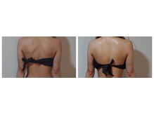 セラフ(Seraph)/ブライダル