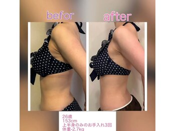 レナトゥス 銀座(Renatus)/BeforeAfter【痩身/東京/銀座】