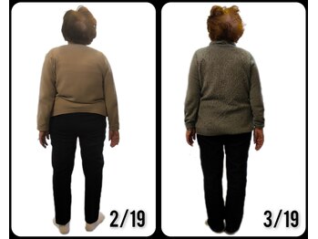 そら/86歳の背中の歪みがあるお客様