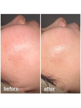 ミニョン(mignon)/梅雨前に…