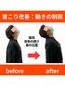 【1か月以上の痛みを初回で解決】1日でも早くつらさをどうにかしたい！