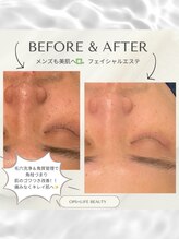 オプス ライフビューティー(OPS×LIFE BEAUTY)/メンズ美容◇メンズフェイシャル